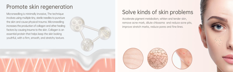 profession microneedle skill can slove kinds of skin problems